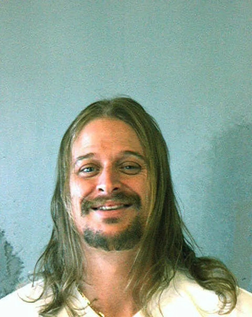 Kid Rock